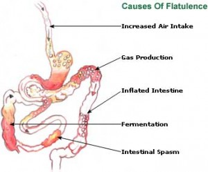 flatulence-picture